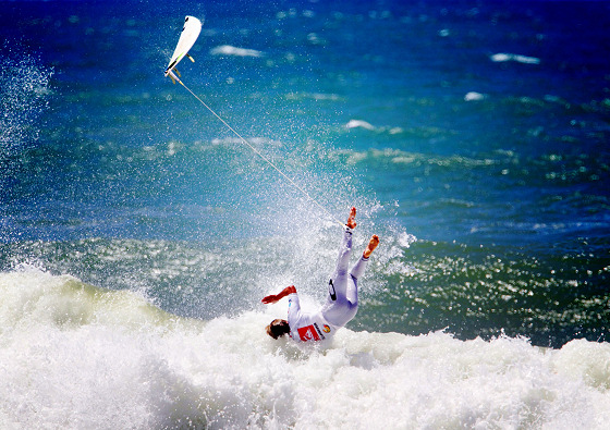 Image surfinjuries.jpg