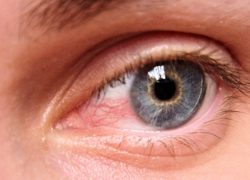 Image surferseye.jpg